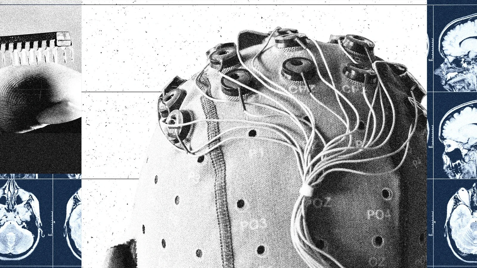 China Is Building a Brain-Computer Interface Industry